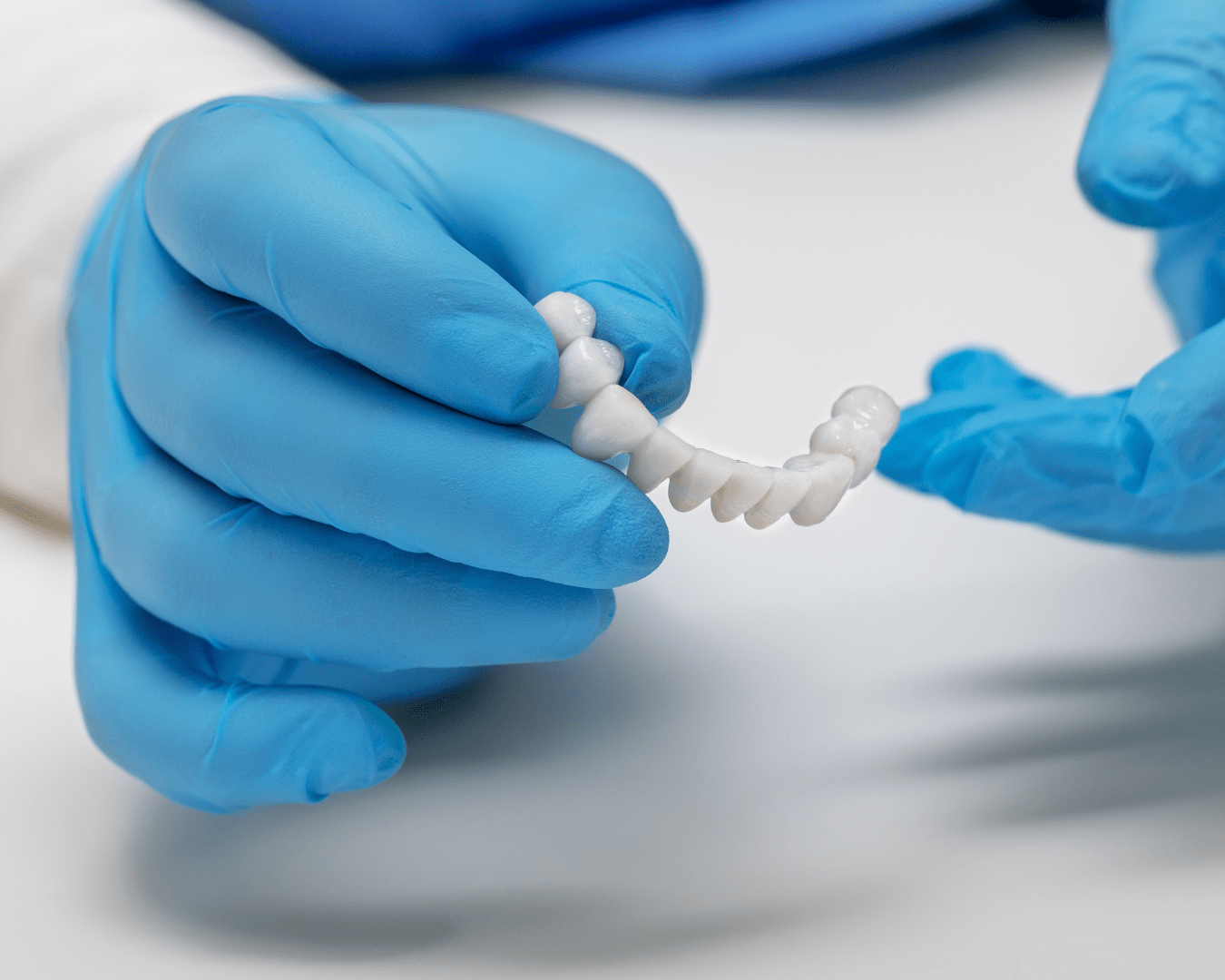 Dentist holds ceramic dental crowns in his hands, zirconium bridge, close-up